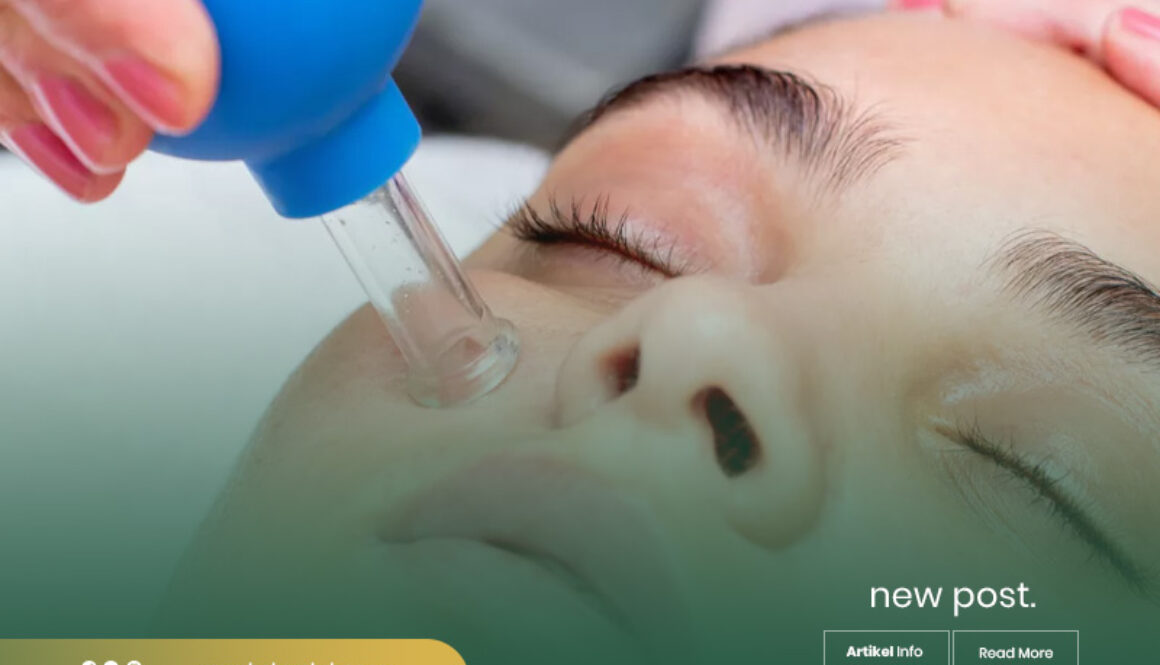 pusat-terapi-bekam-dan-gurah-malang