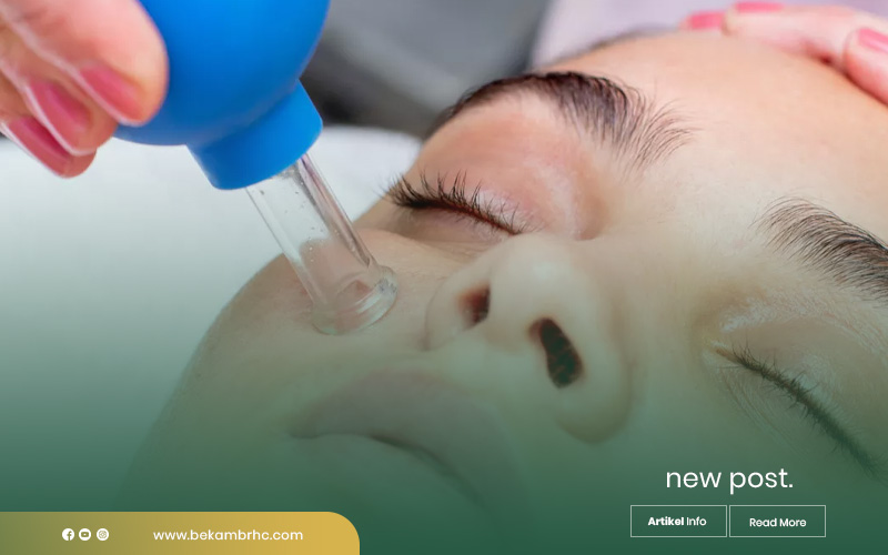 pusat-terapi-bekam-dan-gurah-malang